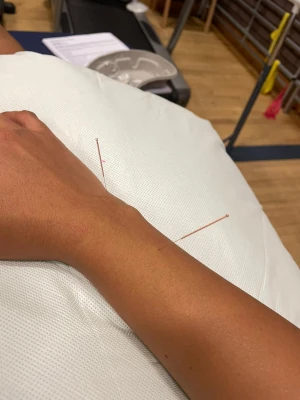 Wrist treatment