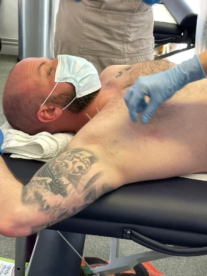 Chest and Armpit Treatment