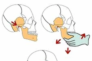 Manipulation of TMJ